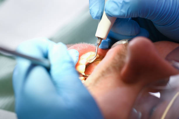 Best Emergency Tooth Extraction  in Pittsburg, KS